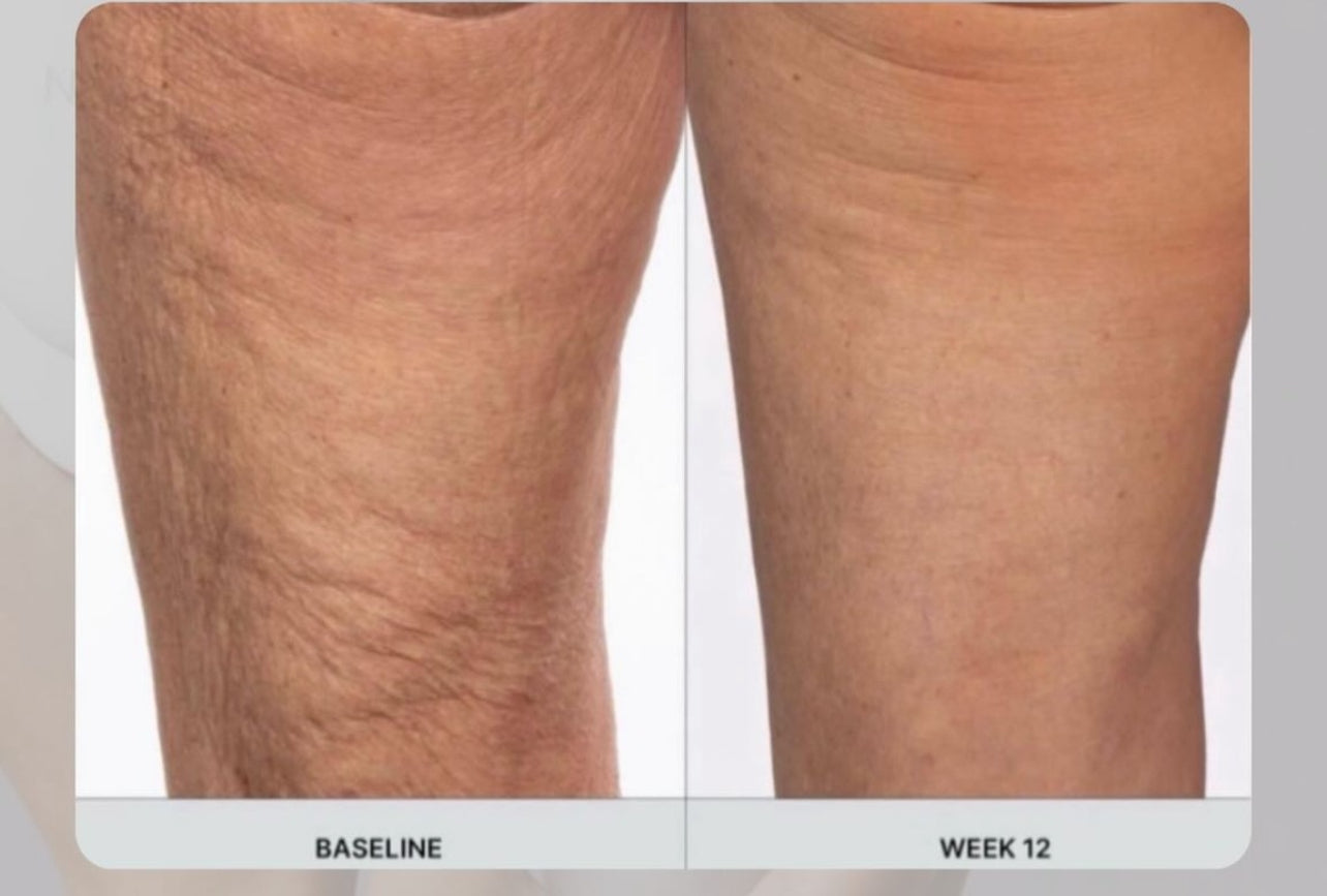 Nuskin RenuSpa iO Microcurrent Body Device