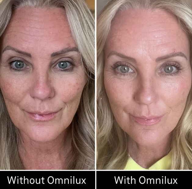 Omnilux LED Contour Face Mask